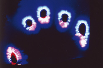 Electrophysionique apres