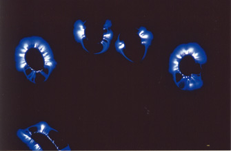 Electrophysionique avant